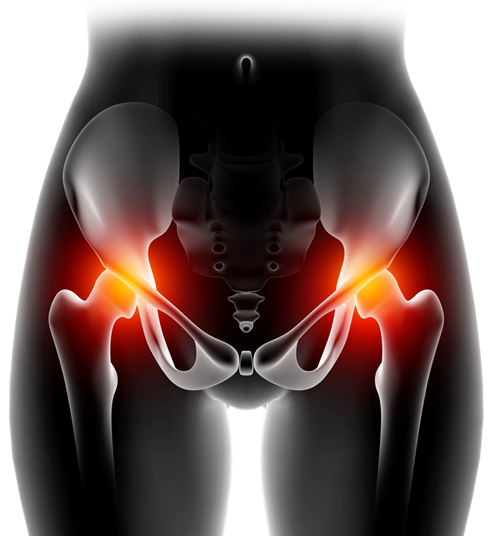 Hip Pain Treatment in West Delhi
