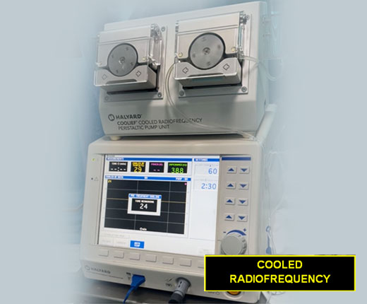 Radiofrequency Ablation (RFA) Treatment in West Delhi, Rajouri Garden